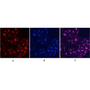 MYPT1 (phospho Thr853)兔多抗,MYPT1 (phospho Thr853) Rabbit Polyclonal Antibody