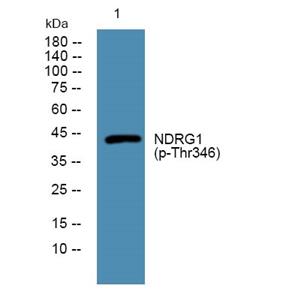 NDRG1 (phospho-Thr346) 兔多抗,NDRG1 (phospho-Thr346)  Rabbit Polyclonal Antibody