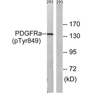 PDGFR-α (phospho Tyr849)兔多抗,PDGFR-α (phospho Tyr849) Rabbit Polyclonal Antibody