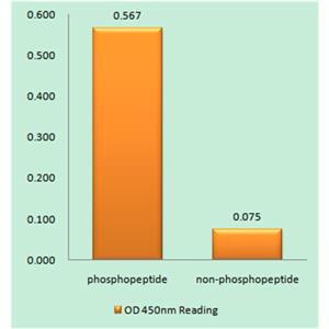 PDGFR-β (phospho Tyr751)兔多抗,PDGFR-β (phospho Tyr751) Rabbit Polyclonal Antibody