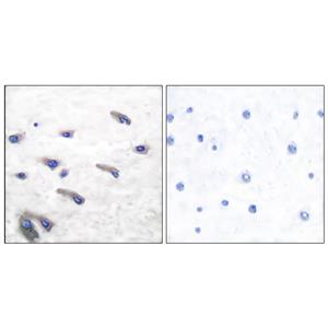 PDGFR-β (phospho Tyr751)兔多抗,PDGFR-β (phospho Tyr751) Rabbit Polyclonal Antibody