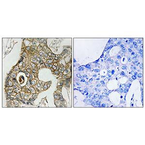 PDGFR-β (phospho Tyr751)兔多抗,PDGFR-β (phospho Tyr751) Rabbit Polyclonal Antibody