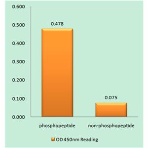 PKC ζ (phospho Thr560)兔多抗,PKC ζ (phospho Thr560) Rabbit Polyclonal Antibody