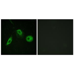 PLC γ2 (phospho Tyr1217)兔多抗,PLC γ2 (phospho Tyr1217) Rabbit Polyclonal Antibody