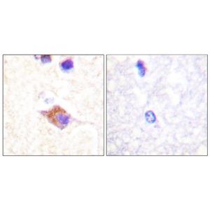 PLC γ2 (phospho Tyr1217)兔多抗,PLC γ2 (phospho Tyr1217) Rabbit Polyclonal Antibody