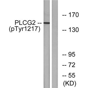 PLC γ2 (phospho Tyr1217)兔多抗,PLC γ2 (phospho Tyr1217) Rabbit Polyclonal Antibody