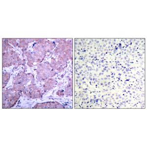 PTEN (phospho Ser380)兔多抗,PTEN (phospho Ser380) Rabbit Polyclonal Antibody