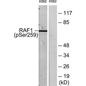 Raf-1 (phospho Ser259)兔多抗,Raf-1 (phospho Ser259) Rabbit Polyclonal Antibody