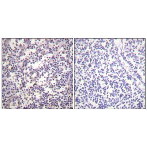 Raf-B (phospho Ser602)兔多抗,Raf-B (phospho Ser602) Rabbit Polyclonal Antibody