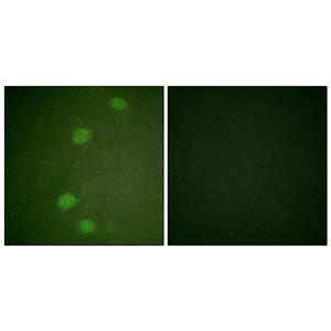 Rb (phospho Ser249)兔多抗,Rb (phospho Ser249) Rabbit Polyclonal Antibody
