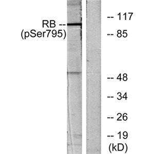 Rb (phospho Ser795)兔多抗,Rb (phospho Ser795) Rabbit Polyclonal Antibody