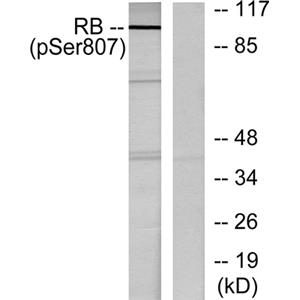 Rb (phospho Ser807)兔多抗,Rb (phospho Ser807) Rabbit Polyclonal Antibody