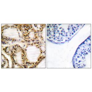 Rb (phospho Thr821)兔多抗,Rb (phospho Thr821) Rabbit Polyclonal Antibody