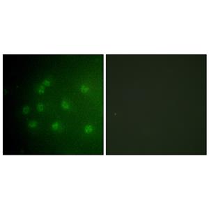 Rb (phospho Thr826)兔多抗,Rb (phospho Thr826) Rabbit Polyclonal Antibody