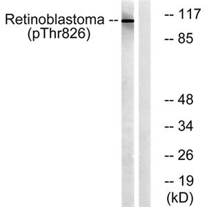 Rb (phospho Thr826)兔多抗,Rb (phospho Thr826) Rabbit Polyclonal Antibody