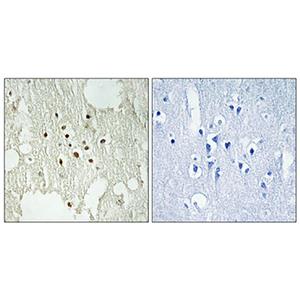 Rb (phospho Thr826)兔多抗,Rb (phospho Thr826) Rabbit Polyclonal Antibody
