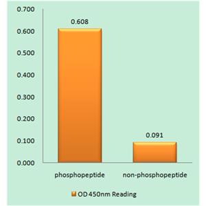 Rho GDIα (phospho Ser174)兔多抗,Rho GDIα (phospho Ser174) Rabbit Polyclonal Antibody