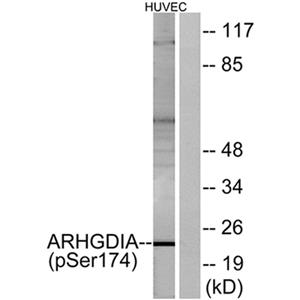 Rho GDIα (phospho Ser174)兔多抗,Rho GDIα (phospho Ser174) Rabbit Polyclonal Antibody