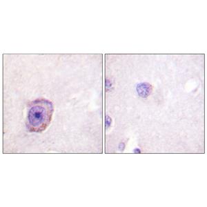 Rhodopsin (phospho Ser334)兔多抗,Rhodopsin (phospho Ser334) Rabbit Polyclonal Antibody