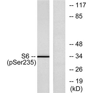 Ribosomal Protein S6 (phospho Ser235)兔多抗,Ribosomal Protein S6 (phospho Ser235) Rabbit Polyclonal Antibody