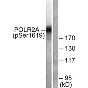 Rpb1 (phospho Ser1619)兔多抗,Rpb1 (phospho Ser1619) Rabbit Polyclonal Antibody