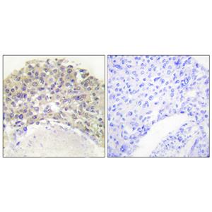 Shc (phospho Tyr349)兔多抗,Shc (phospho Tyr349) Rabbit Polyclonal Antibody
