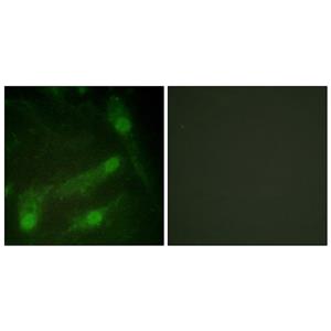 Smad2 (phospho Thr220)兔多抗,Smad2 (phospho Thr220) Rabbit Polyclonal Antibody