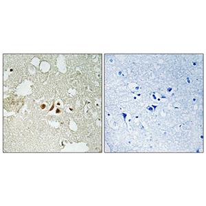 Smad2 (phospho Thr220)兔多抗,Smad2 (phospho Thr220) Rabbit Polyclonal Antibody