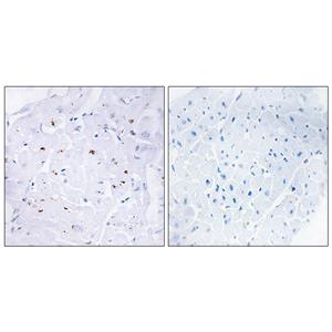 Smad3 (phospho Thr179)兔多抗,Smad3 (phospho Thr179) Rabbit Polyclonal Antibody