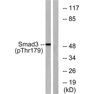 Smad3 (phospho Thr179)兔多抗,Smad3 (phospho Thr179) Rabbit Polyclonal Antibody