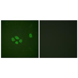 Sox-9 (phospho Ser181)兔多抗,Sox-9 (phospho Ser181) Rabbit Polyclonal Antibody