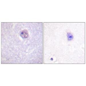 Sox-9 (phospho Ser181)兔多抗,Sox-9 (phospho Ser181) Rabbit Polyclonal Antibody