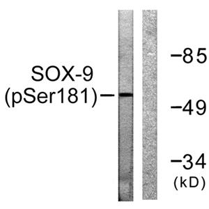 Sox-9 (phospho Ser181)兔多抗,Sox-9 (phospho Ser181) Rabbit Polyclonal Antibody