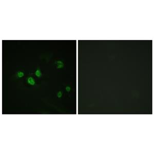 Sp1 (phospho Thr453)兔多抗,Sp1 (phospho Thr453) Rabbit Polyclonal Antibody