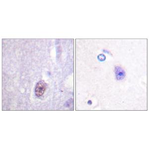 Sp1 (phospho Thr453)兔多抗,Sp1 (phospho Thr453) Rabbit Polyclonal Antibody