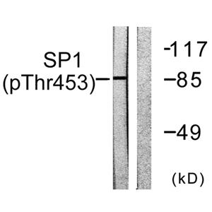 Sp1 (phospho Thr453)兔多抗,Sp1 (phospho Thr453) Rabbit Polyclonal Antibody