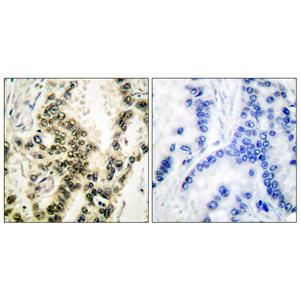 SRF (phospho Ser103)兔多抗,SRF (phospho Ser103) Rabbit Polyclonal Antibody