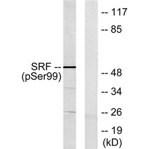 SRF (phospho Ser103)兔多抗,SRF (phospho Ser103) Rabbit Polyclonal Antibody
