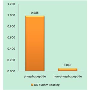 Stat2 (phospho Tyr690)兔多抗,Stat2 (phospho Tyr690) Rabbit Polyclonal Antibody