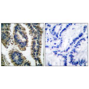 Stat2 (phospho Tyr690)兔多抗,Stat2 (phospho Tyr690) Rabbit Polyclonal Antibody