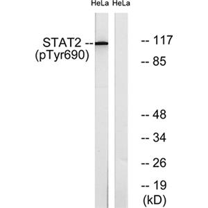 Stat2 (phospho Tyr690)兔多抗,Stat2 (phospho Tyr690) Rabbit Polyclonal Antibody