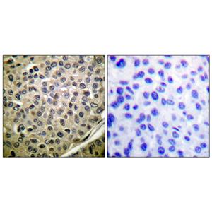 Stat4 (phospho Tyr693)兔多抗,Stat4 (phospho Tyr693) Rabbit Polyclonal Antibody