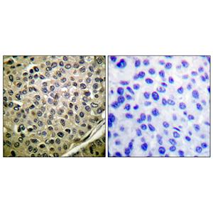 Stat4 (phospho Tyr693)兔多抗,Stat4 (phospho Tyr693) Rabbit Polyclonal Antibody