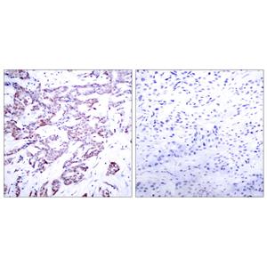 Stat6 (phospho Thr645)兔多抗,Stat6 (phospho Thr645) Rabbit Polyclonal Antibody