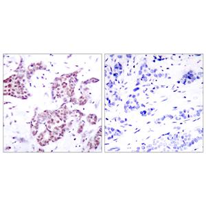 Stat6 (phospho Tyr641)兔多抗,Stat6 (phospho Tyr641) Rabbit Polyclonal Antibody