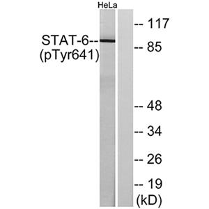 Stat6 (phospho Tyr641)兔多抗,Stat6 (phospho Tyr641) Rabbit Polyclonal Antibody