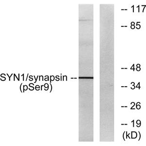 Synapsin I (phospho Ser9)兔多抗,Synapsin I (phospho Ser9) Rabbit Polyclonal Antibody