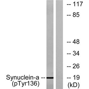 Synuclein-α (phospho Tyr136)兔多抗,Synuclein-α (phospho Tyr136) Rabbit Polyclonal Antibody