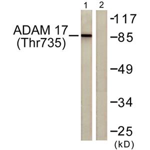 TACE (phospho Thr735)兔多抗,TACE (phospho Thr735) Rabbit Polyclonal Antibody
