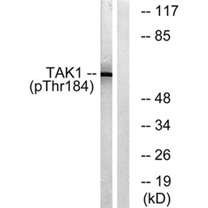 Tak1 (phospho Thr184)兔多抗,Tak1 (phospho Thr184) Rabbit Polyclonal Antibody